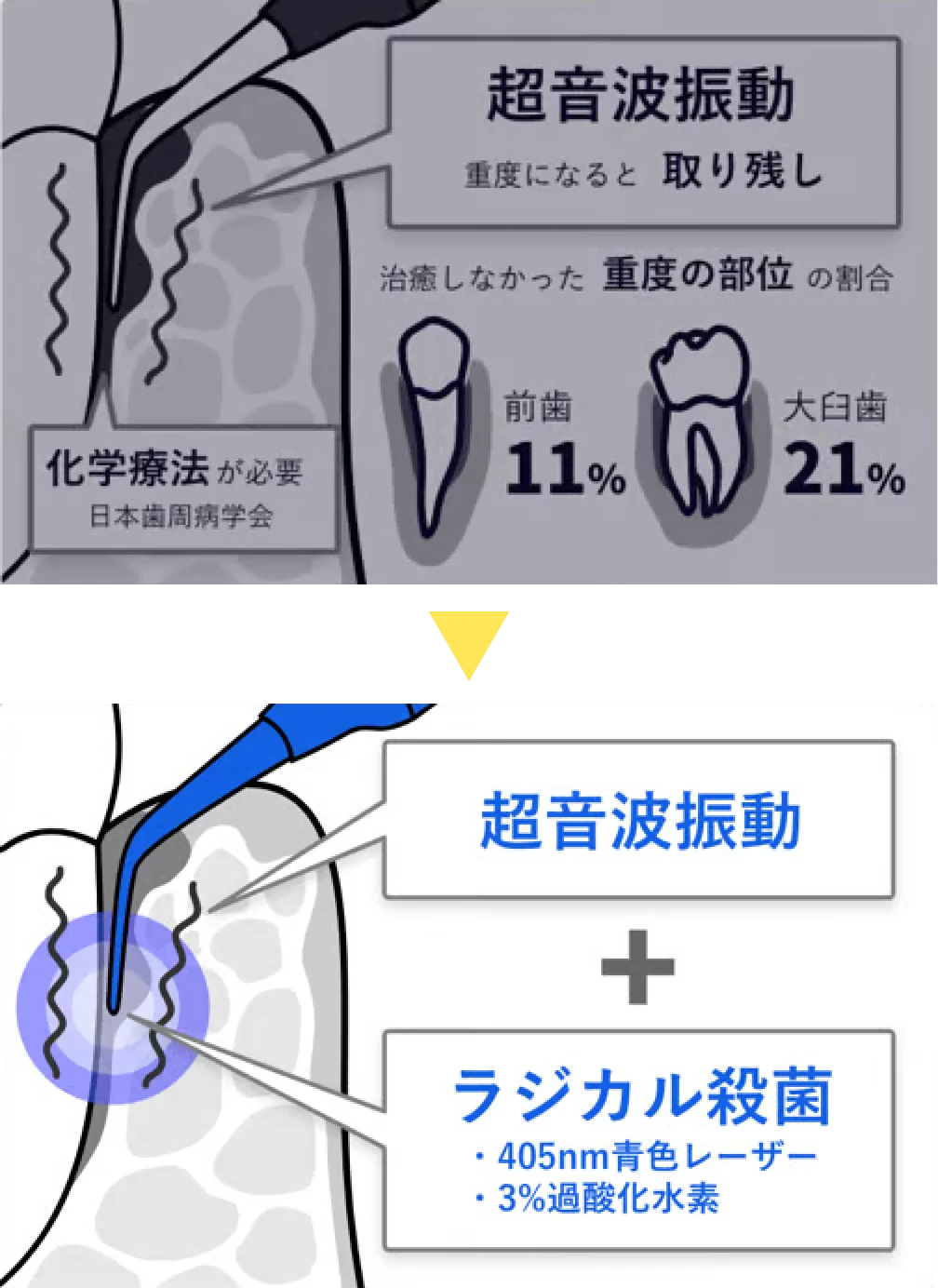 従来の治療法と「ブルーラジカル」の違いを表した図