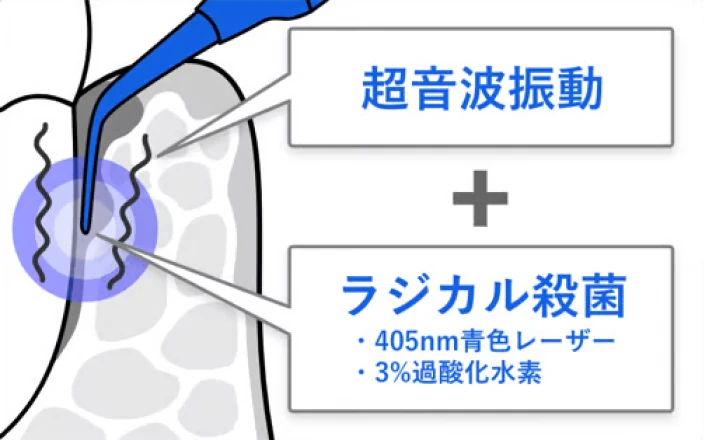 ブルーラジカル治療の図